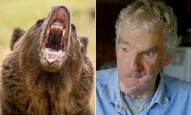 Man Who Had Face Torn Off By Bear Describes How He Managed To Survive Hot Lifestyle News 2117